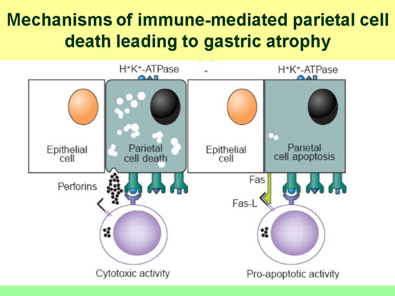 Mechanisms of immune-mediated parietal cell death leading to gastric atrophy